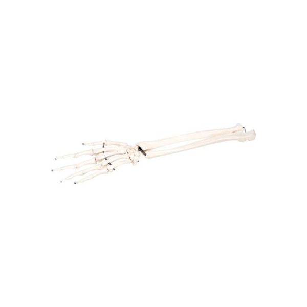 3B Anatomical Model - Loose Bones, Hand Skeleton with Ulna and Radius, Right